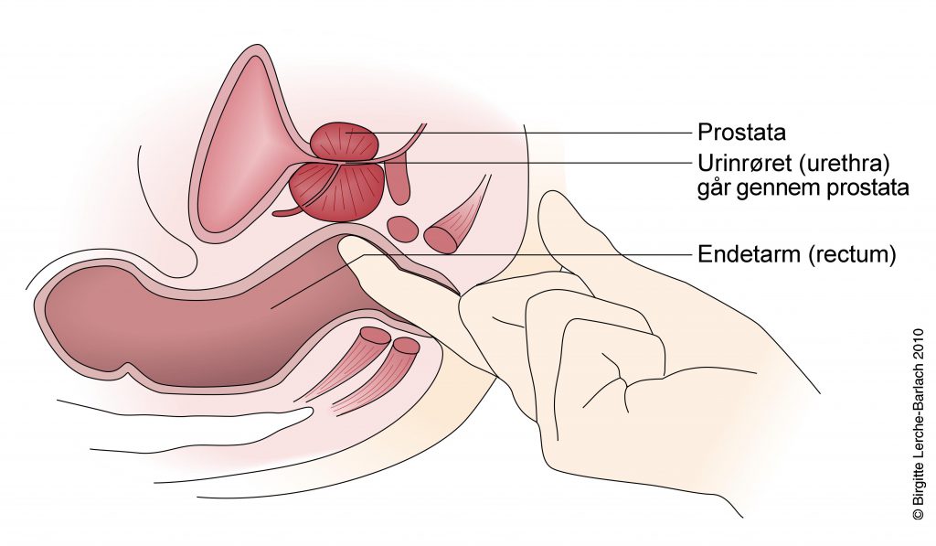 Prostata massage i Roskilde