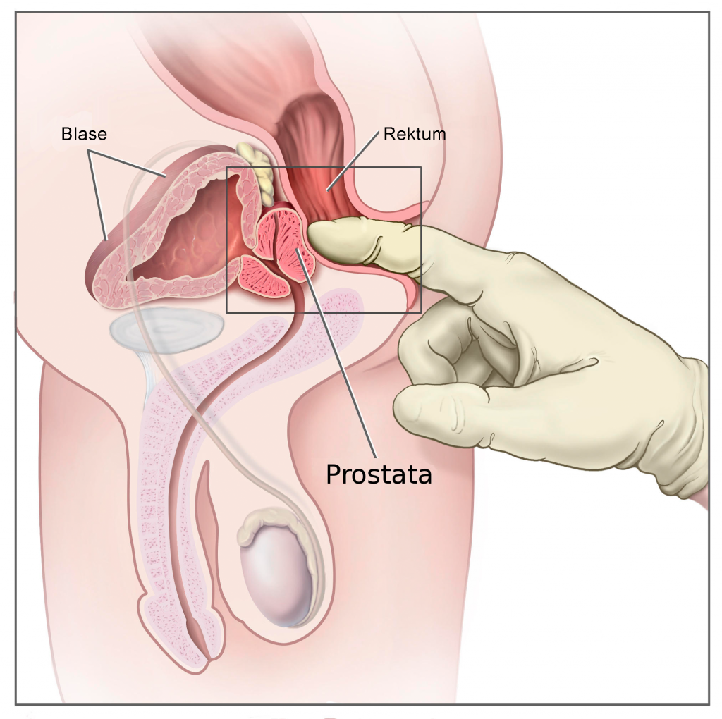 prostata massage i Roskilde